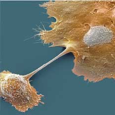 Breast cancer cells